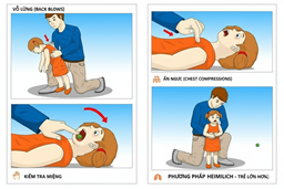Kỹ Năng Sơ Cấp Cứu: Xử Lý Khi Trẻ Bị Hóc Dị Vật